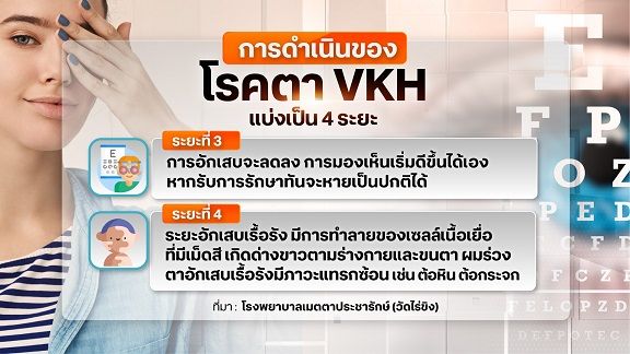 อันตรายโรคตา VKH รักษาช้า ไม่ถูกวิธี เสี่ยงตาบอดถาวร