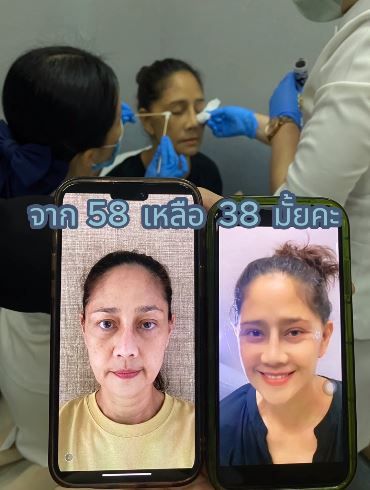 เผยใบหน้าล่าสุด!! นก สินจัย ตัดสินใจทำศัลยกรรมหน้าดูเด็กลง 20 ปี