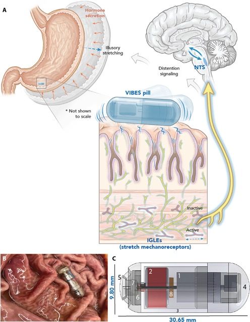 ยาสั่นหลอกสมองว่าท้องอิ่ม เทคโนโลยีใหม่จาก MIT ช่วยลดความอ้วน