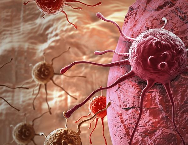 นักวิจัยคิดค้นวิธีวินิจฉัยมะเร็งต่อมลูกหมาก ด้วยปัสสาวะและ AI !!