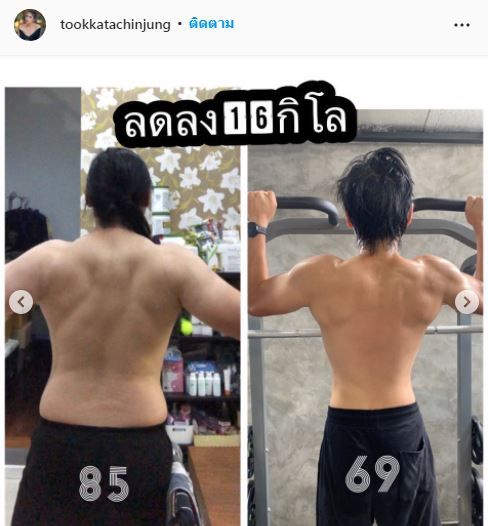 รู้จักโรคโปรตีนรั่ว ตุ๊กตา แชร์ประสบการณ์ของสามี ตัวบวมน้ำหนักขึ้นเกือบ 100 กิโล!!