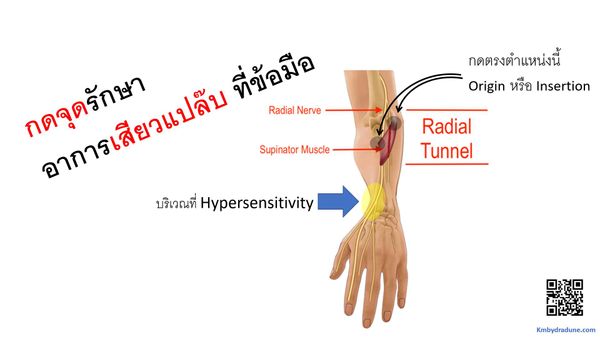 ใครมีอาการเสียวแปล๊บๆ ที่ข้อมือ หมอแนะวิธีกดจุดแก้ไขได้