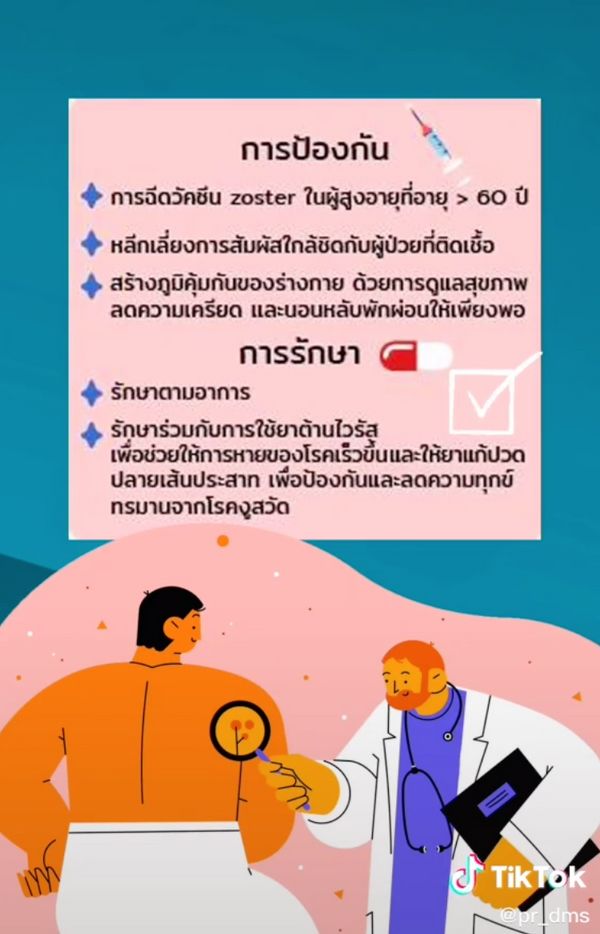 โหมงานหนัก-พักผ่อนน้อยพึงระวัง! เสี่ยงเกิดโรคงูสวัด 