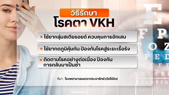 อันตรายโรคตา VKH รักษาช้า ไม่ถูกวิธี เสี่ยงตาบอดถาวร