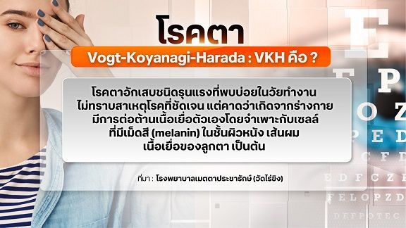 อันตรายโรคตา VKH รักษาช้า ไม่ถูกวิธี เสี่ยงตาบอดถาวร