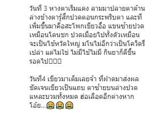 ปอย ปวีณา โพสต์ตาเขียวช้ำ เป็นอุทาหรณ์จากการเล่นสเก็ตบอร์ด 