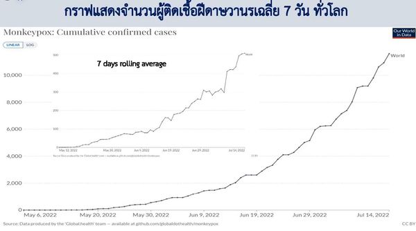 โรคฝีดาษลิง รายแรกในไทย เป็นสายพันธุ์แอฟริกาตะวันตก สัมผัสเสี่ยงสูง 2 ราย