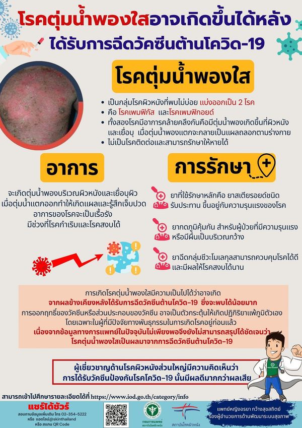 แพทย์ชี้ โรคตุ่มน้ำพองใส หลังฉีดวัคซีนโควิด-19 พบได้น้อย รักษาหายได้