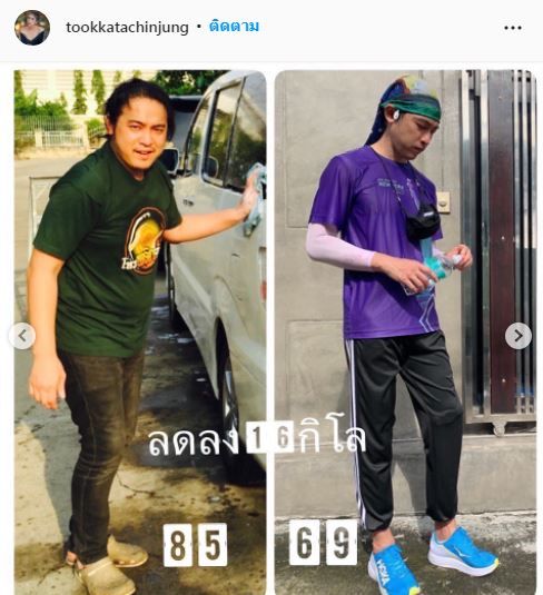 รู้จักโรคโปรตีนรั่ว ตุ๊กตา แชร์ประสบการณ์ของสามี ตัวบวมน้ำหนักขึ้นเกือบ 100 กิโล!!