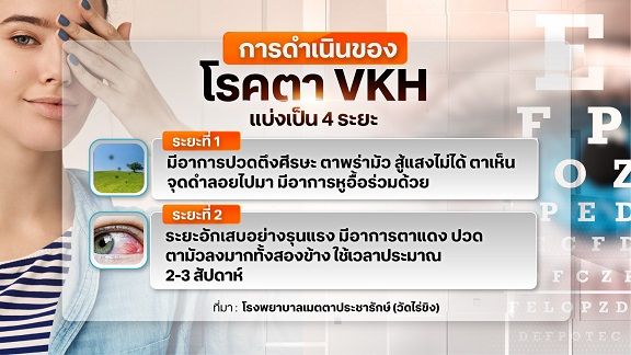 อันตรายโรคตา VKH รักษาช้า ไม่ถูกวิธี เสี่ยงตาบอดถาวร