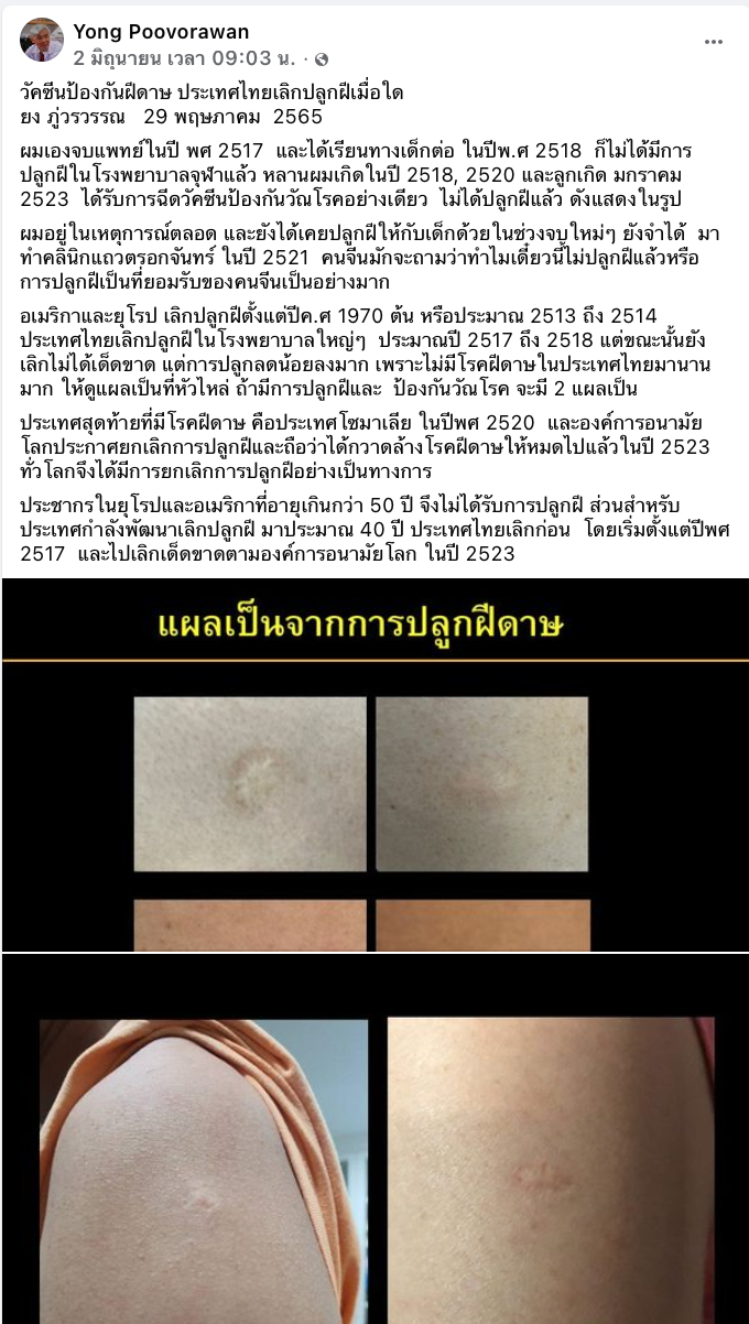 หมอยงไขข้อสงสัย ไทยเลิก “ปลูกฝี” เมื่อใด?