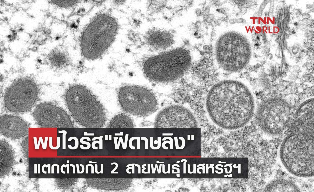 CDC เผยพบไวรัส “ฝีดาษลิง” แตกต่างกัน 2 สายพันธุ์ในสหรัฐฯ