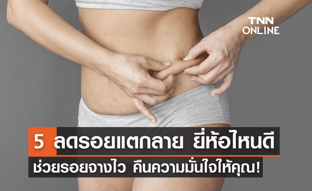 5 ครีมลดรอยแตกลาย ยี่ห้อไหนดี ช่วยรอยจางไว คืนความมั่นใจ