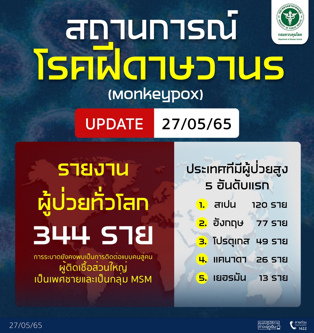 ฝีดาษลิง สธ.เผยทั่วโลกพบ 344 ราย แนะ 2 ข้อปชช.ควรทำห่างไกลติดเชื้อ