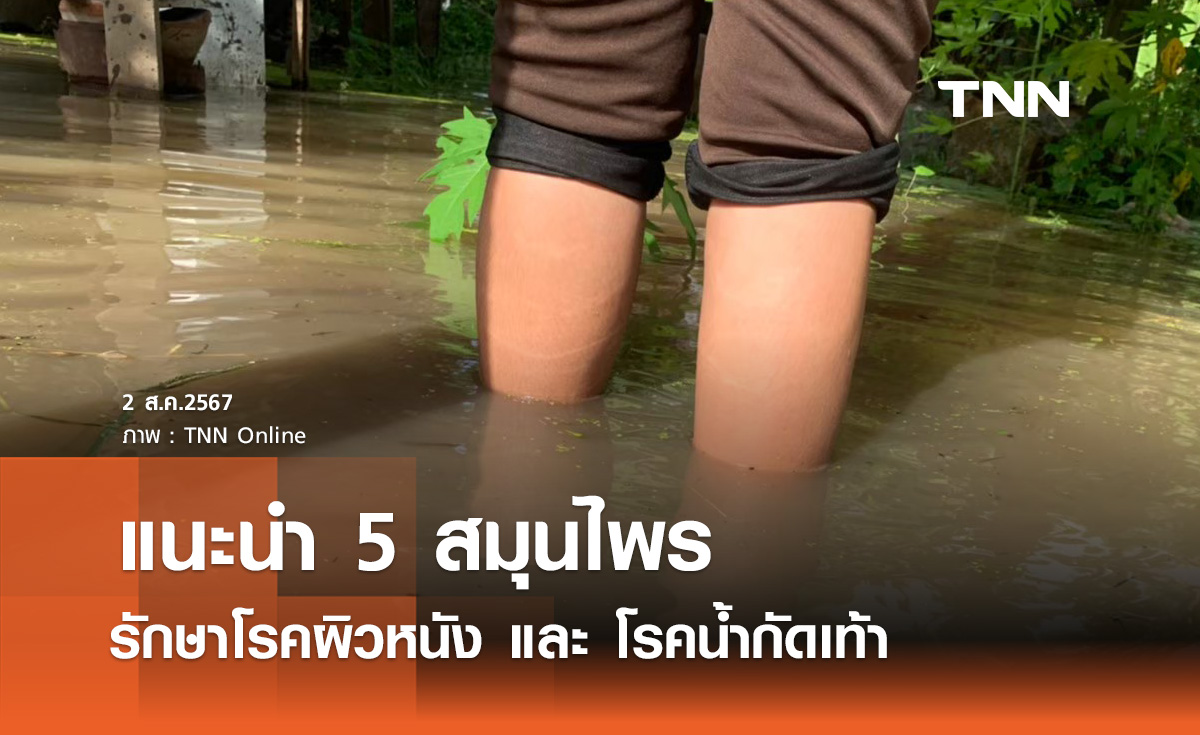 แนะ 5 สมุนไพร รักษาอาการ โรคผิวหนัง - น้ำกัดเท้า ช่วงฤดูฝน