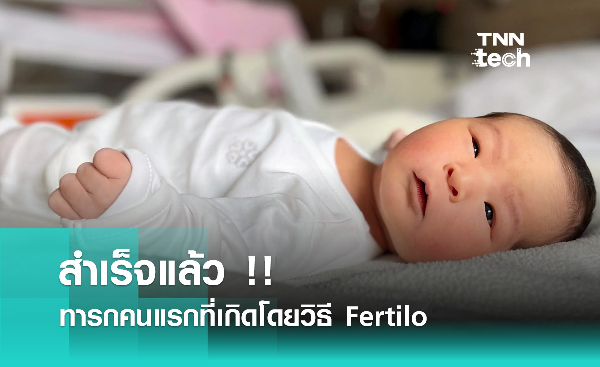 สำเร็จแล้ว !! ทารกคนแรกที่เกิดโดยวิธี Fertilo