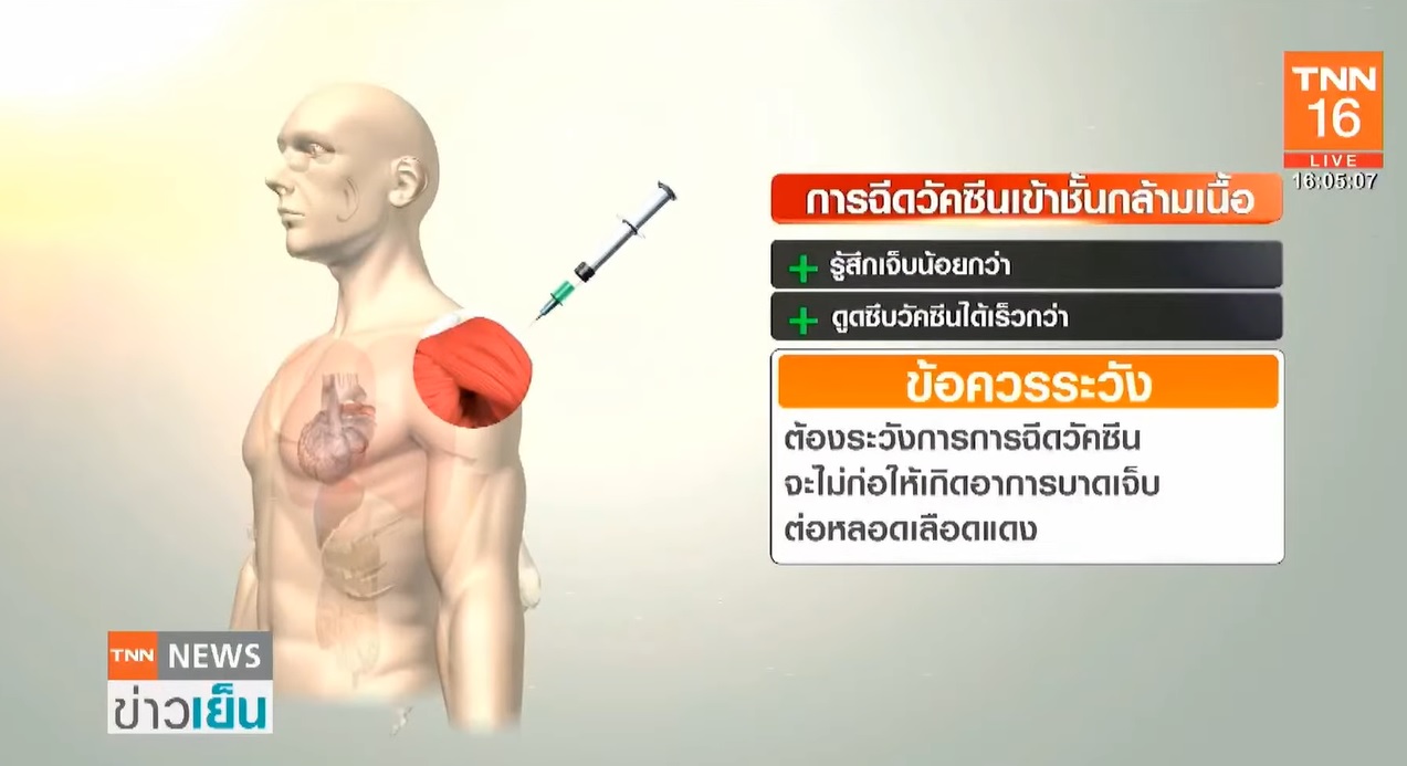 คลายสงสัย! ทำไมต้องฉีดวัคซีนโควิด-19 ที่ต้นแขนหรือหัวไหล่?