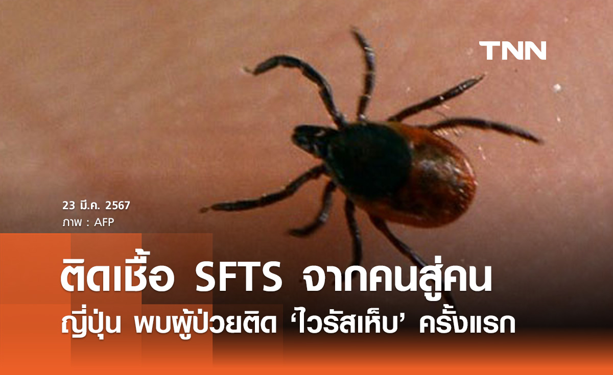 ญี่ปุ่น พบการติดโรค "ไวรัสเห็บ SFTS" จากคนสู่คนเป็นครั้งแรก