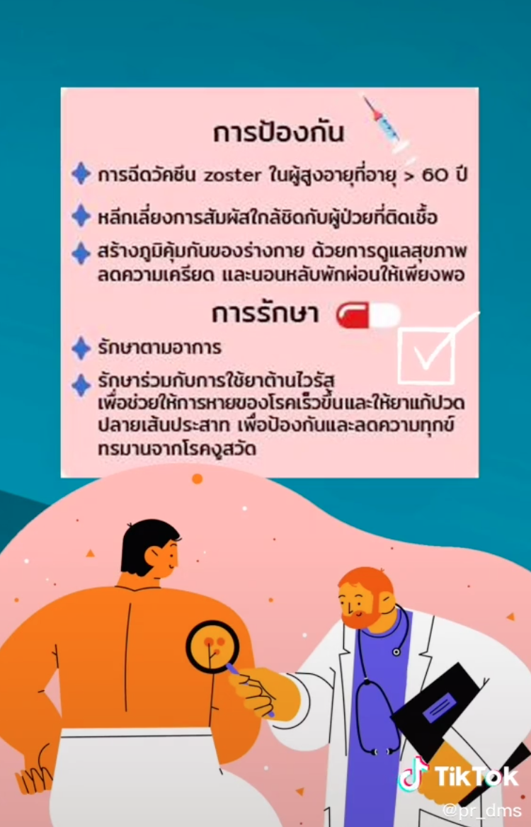 โหมงานหนัก-พักผ่อนน้อยพึงระวัง! เสี่ยงเกิดโรคงูสวัด โหมงานหนัก-พักผ่อนน้อยพึงระวัง! เสี่ยงเกิดโรคงูสวัด