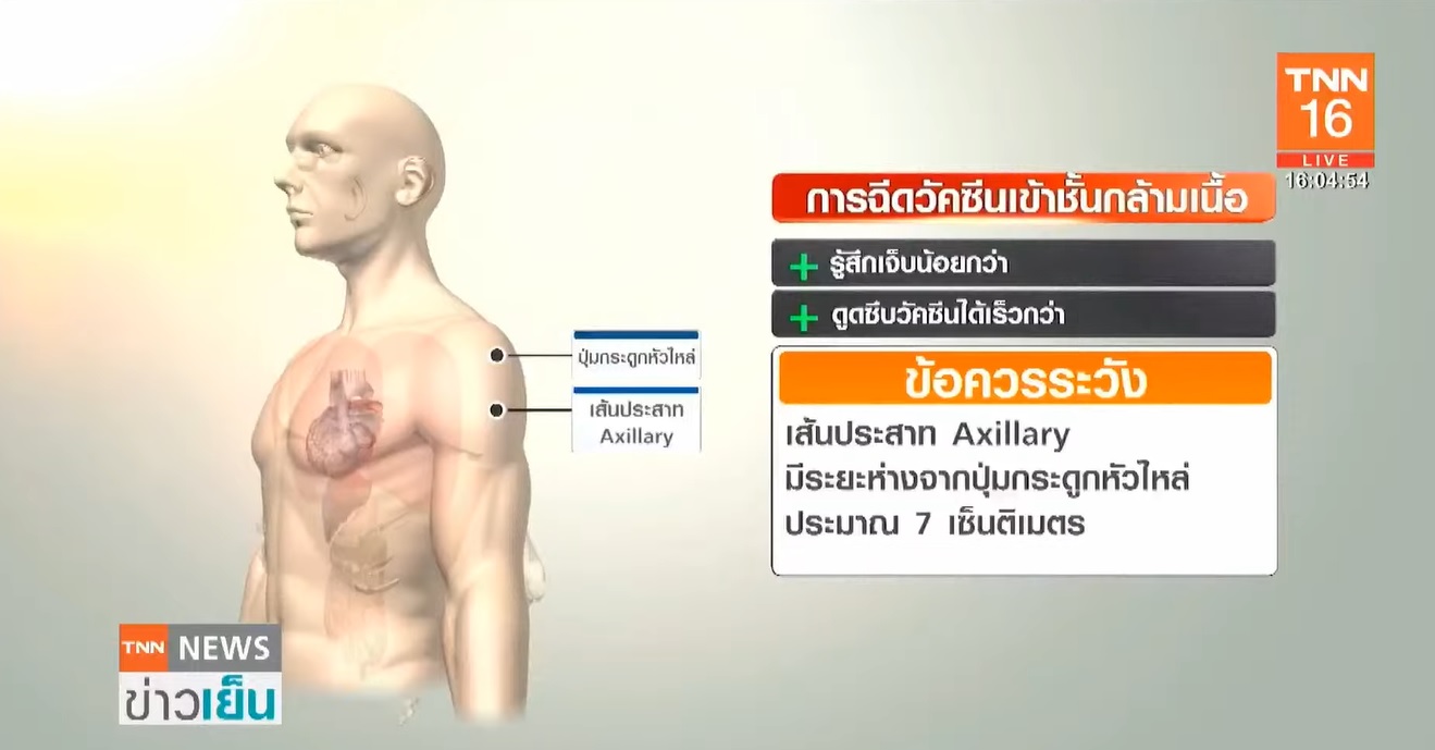 คลายสงสัย! ทำไมต้องฉีดวัคซีนโควิด-19 ที่ต้นแขนหรือหัวไหล่?