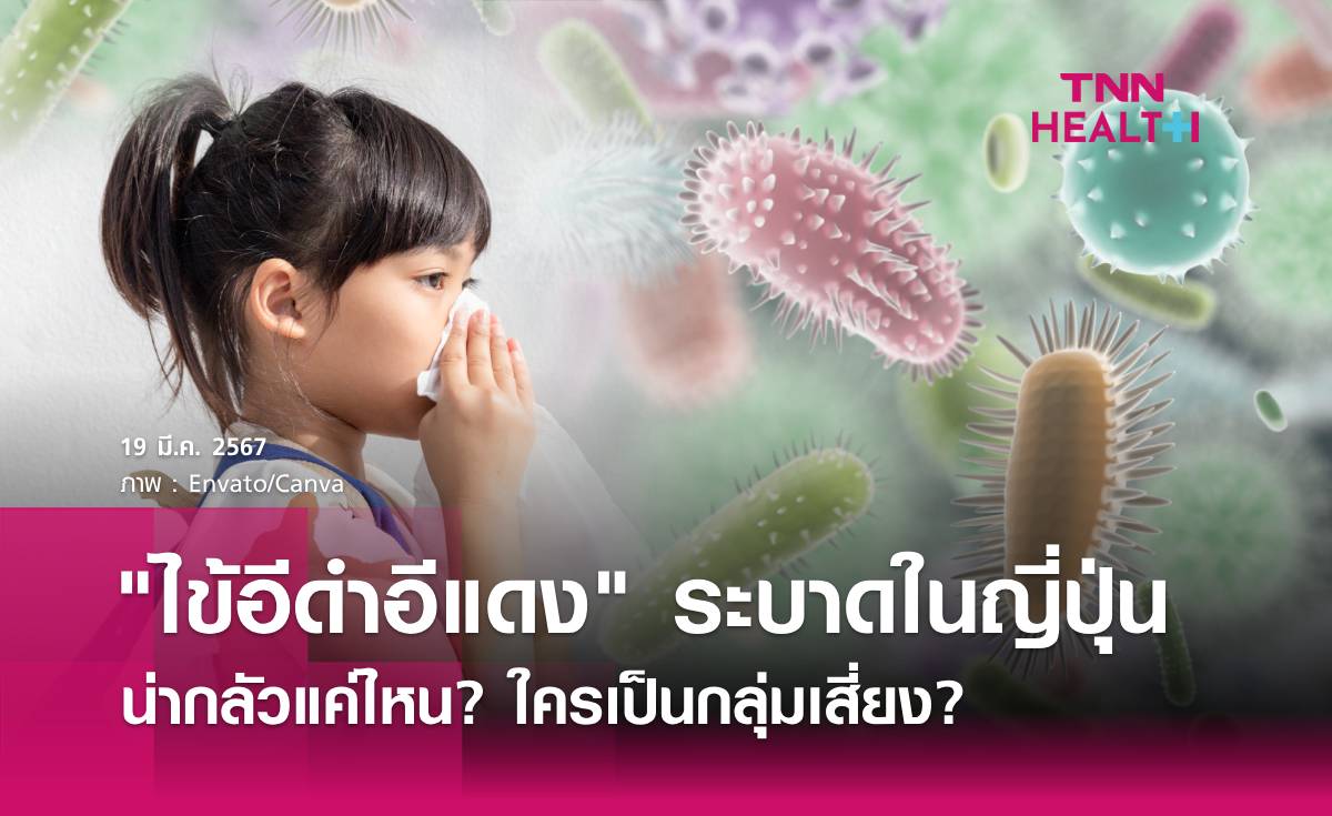 "โรคไข้อีดำอีแดง" กำลังระบาดในญี่ปุ่น น่ากลัวแค่ไหน?