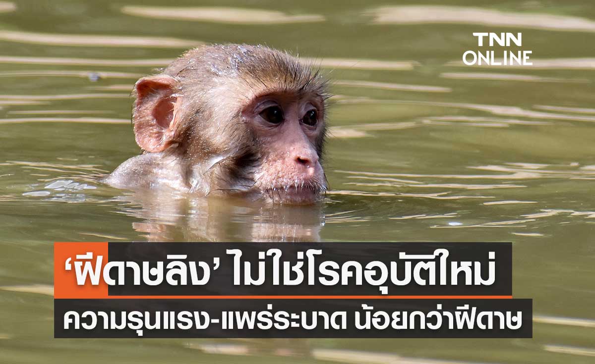 หมอยง เผย ฝีดาษลิง ยังไม่พบในไทย ความรุนแรง-การแพร่ระบาดน้อยกว่าฝีดาษมาก