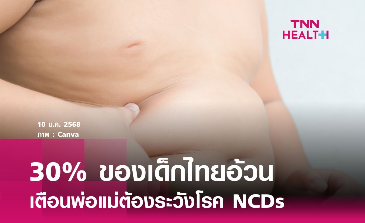 30% ของเด็กไทยอ้วน เตือนพ่อแม่ต้องระวังโรค NCDs 