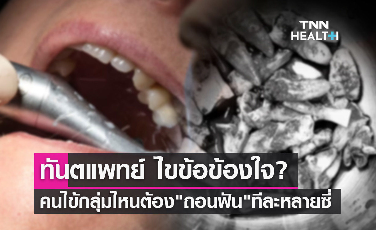 ทันตแพทย์ ไขข้อข้องใจ? คนไข้กลุ่มไหนต้องเร่ง 