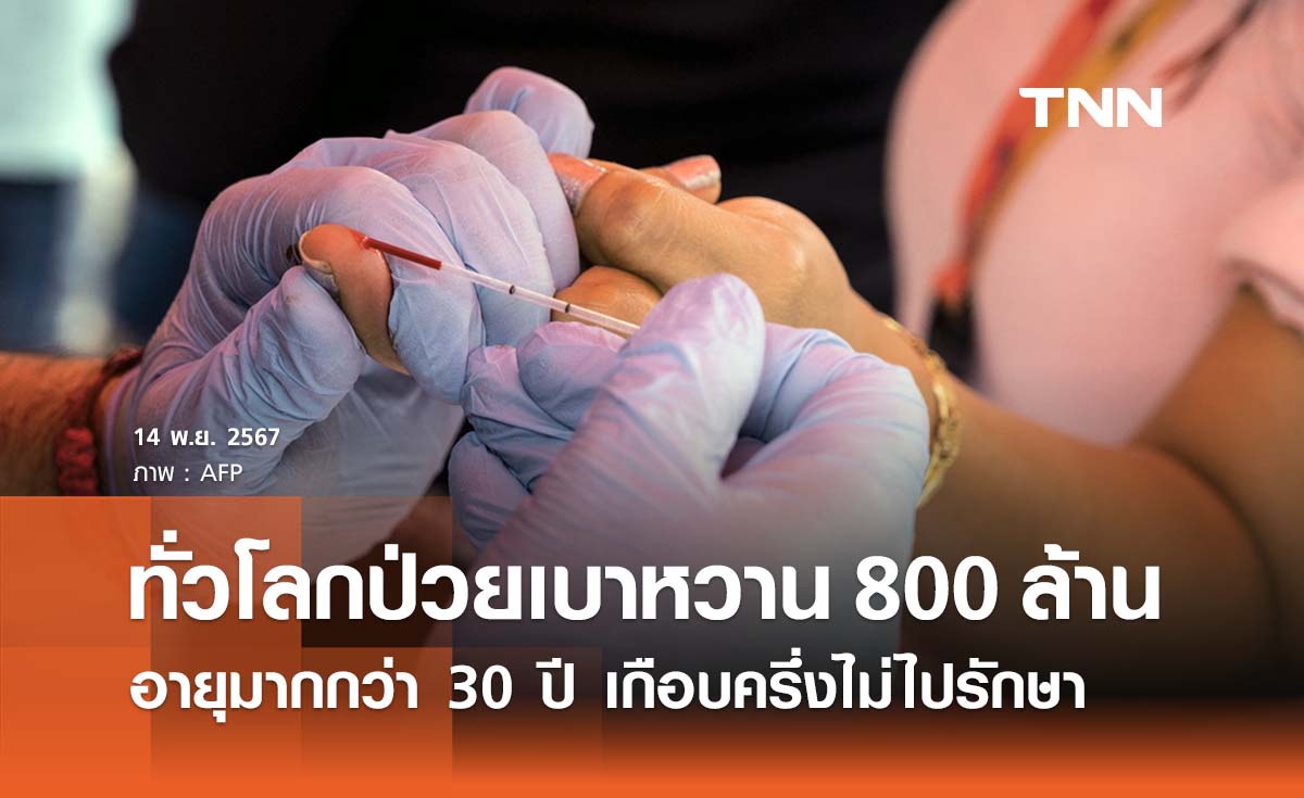 “โรคเบาหวาน” พบผู้ป่วยทั่วโลก 800 ล้านคน เกือบครึ่งไม่เข้ารับการรักษา