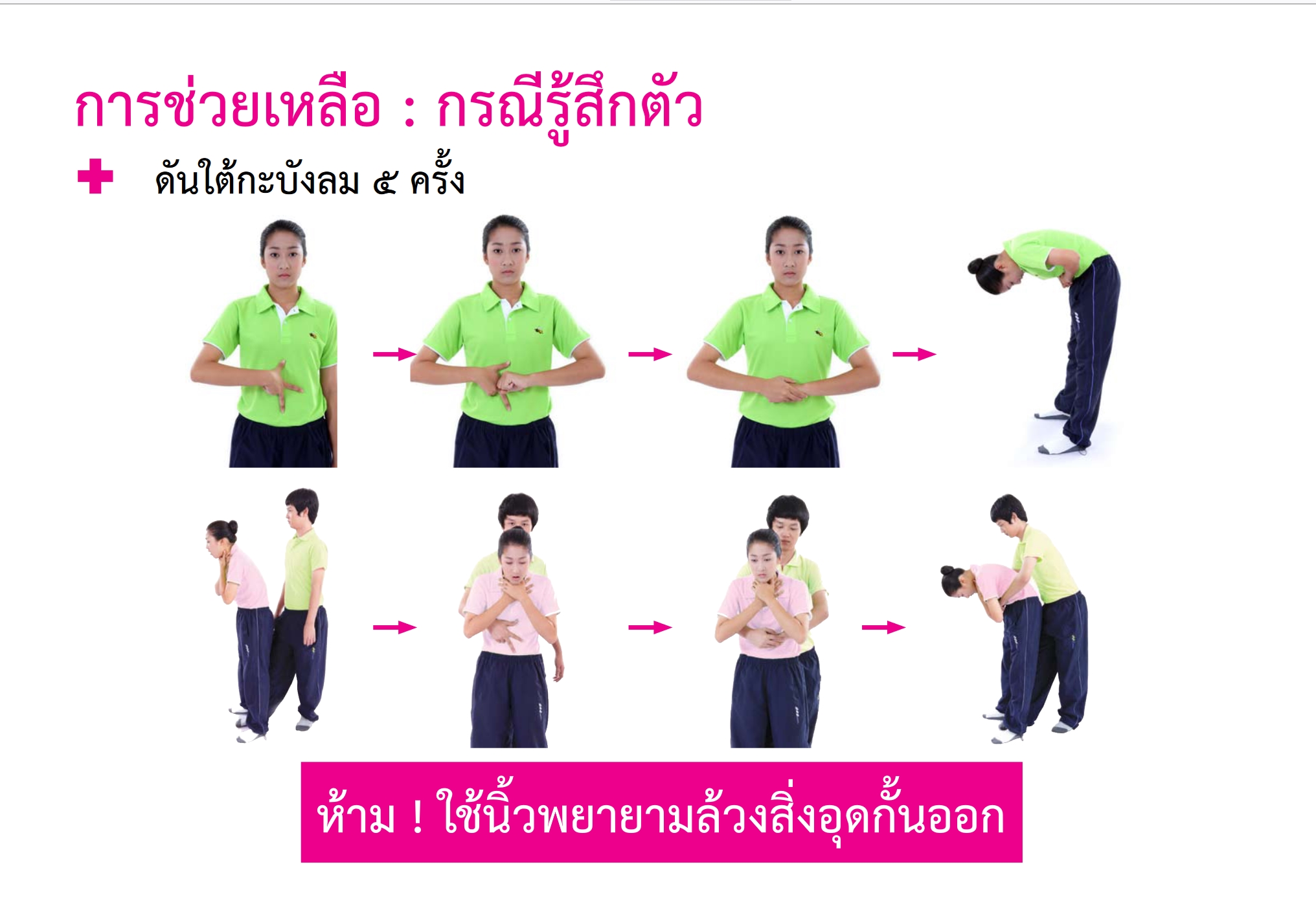 สำลักอาหาร ทำอย่างไร? เปิดวิธีปฐมพยาบาล ขั้นตอนสำคัญยามฉุกเฉิน