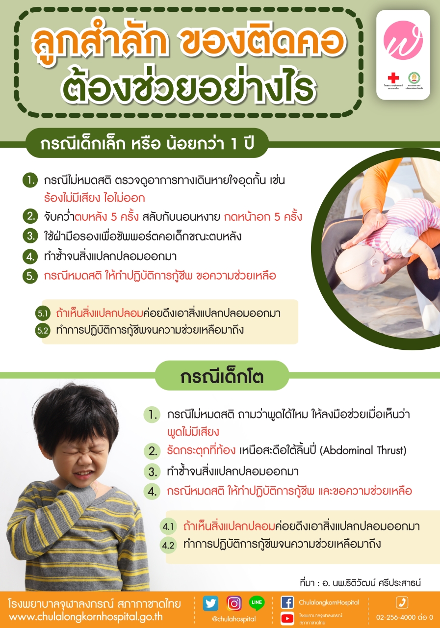 สำลักอาหาร ทำอย่างไร? เปิดวิธีปฐมพยาบาล ขั้นตอนสำคัญยามฉุกเฉิน