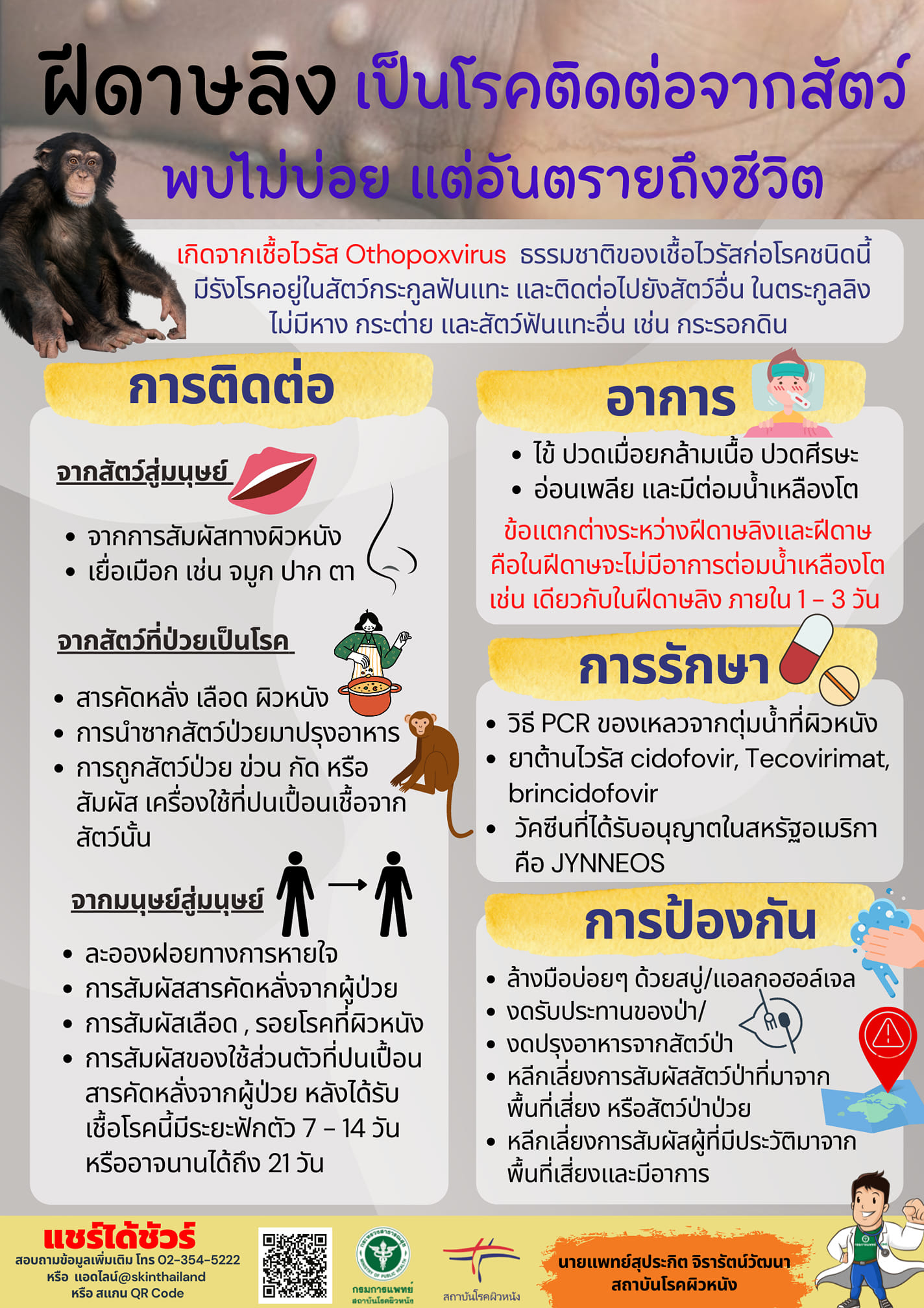 แพทย์ผิวหนังเตือน ฝีดาษลิง เป็นโรคติดต่อจากสัตว์ที่พบไม่บ่อย แต่อันตรายถึงชีวิต แพทย์ผิวหนังเตือน ฝีดาษลิง เป็นโรคติดต่อจากสัตว์ที่พบไม่บ่อย แต่อันตรายถึงชีวิต