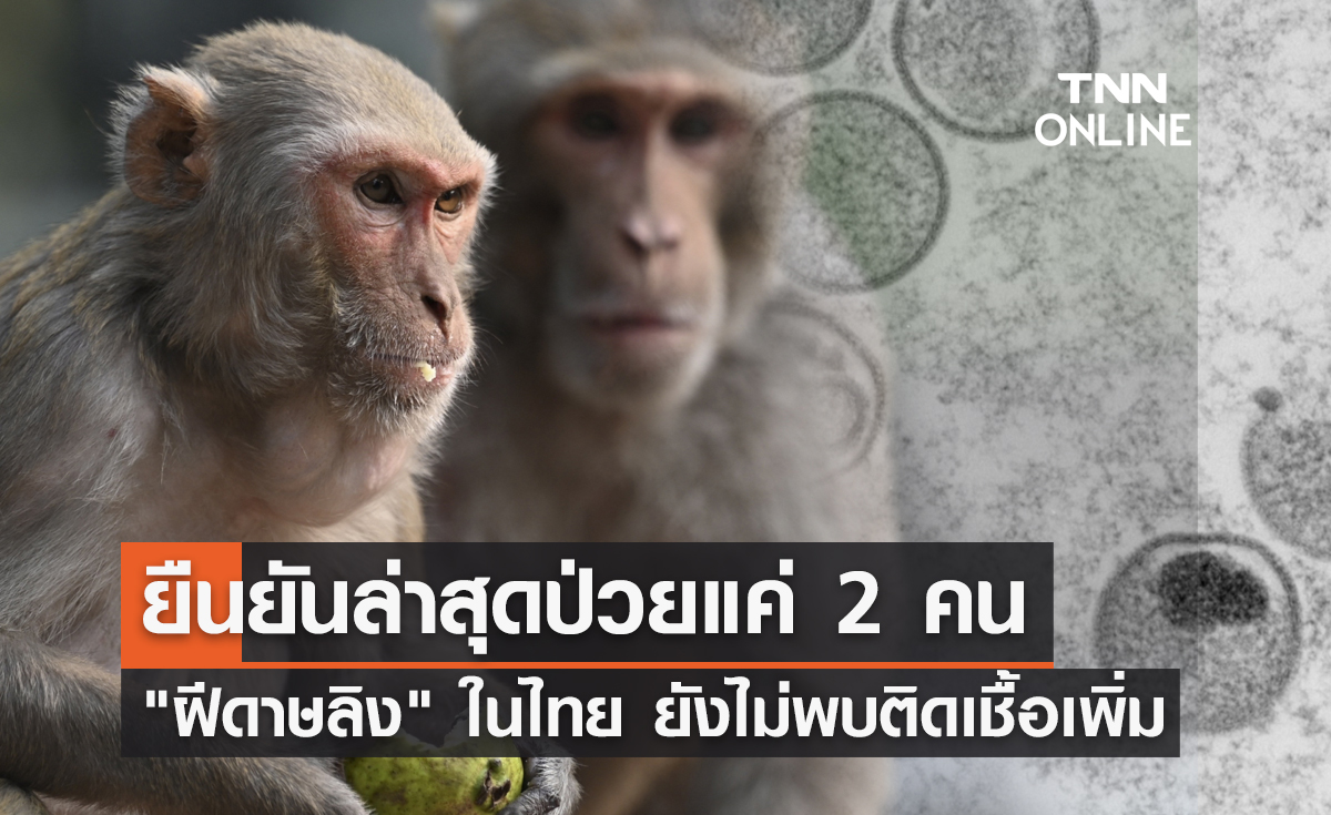 ฝีดาษลิง ในไทย ยังไม่พบติดเชื้อเพิ่ม ยืนยันป่วยแค่ 2 คน