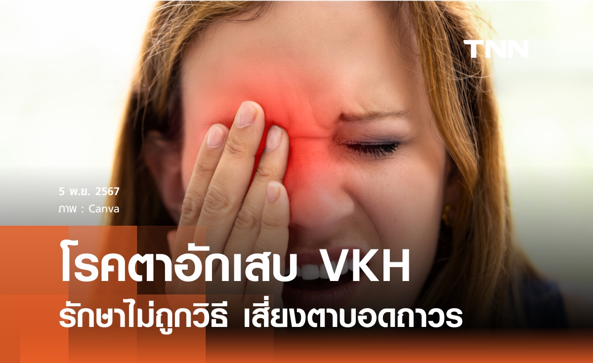 อันตรายโรคตา VKH รักษาช้า ไม่ถูกวิธี เสี่ยงตาบอดถาวร