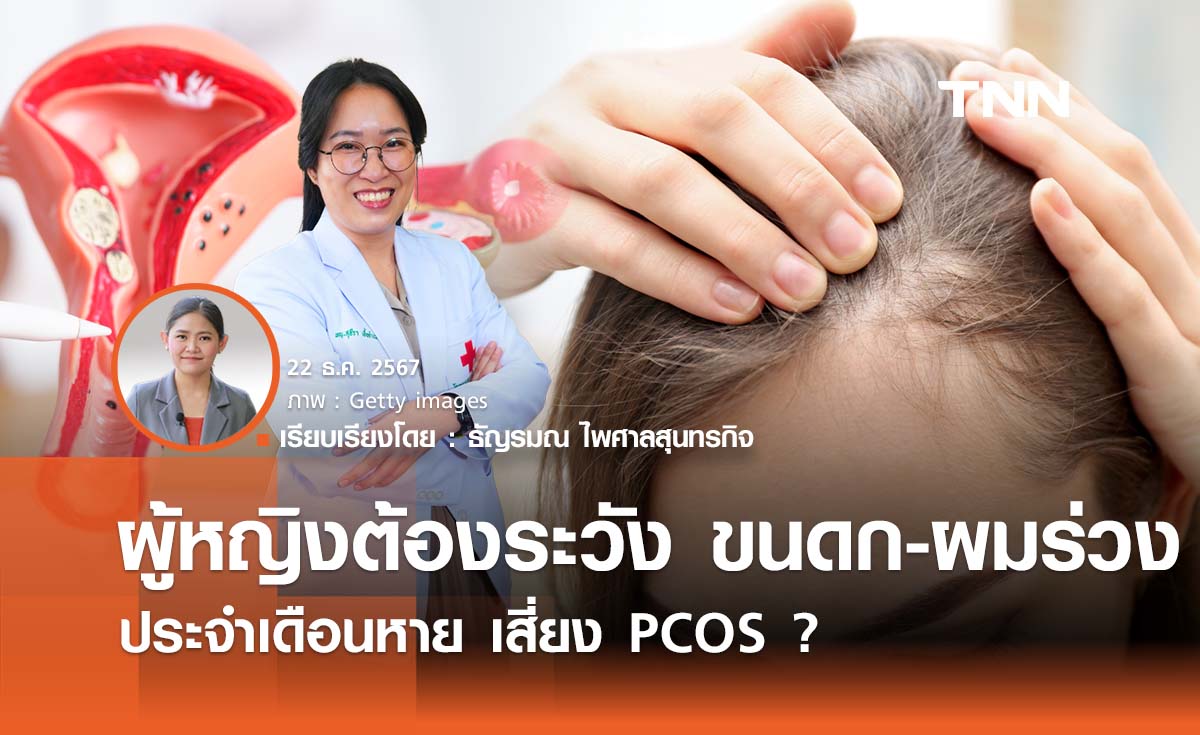 ผู้หญิงต้องระวัง ขนดก-ผมร่วง ประจำเดือนหาย เสี่ยง PCOS ?  