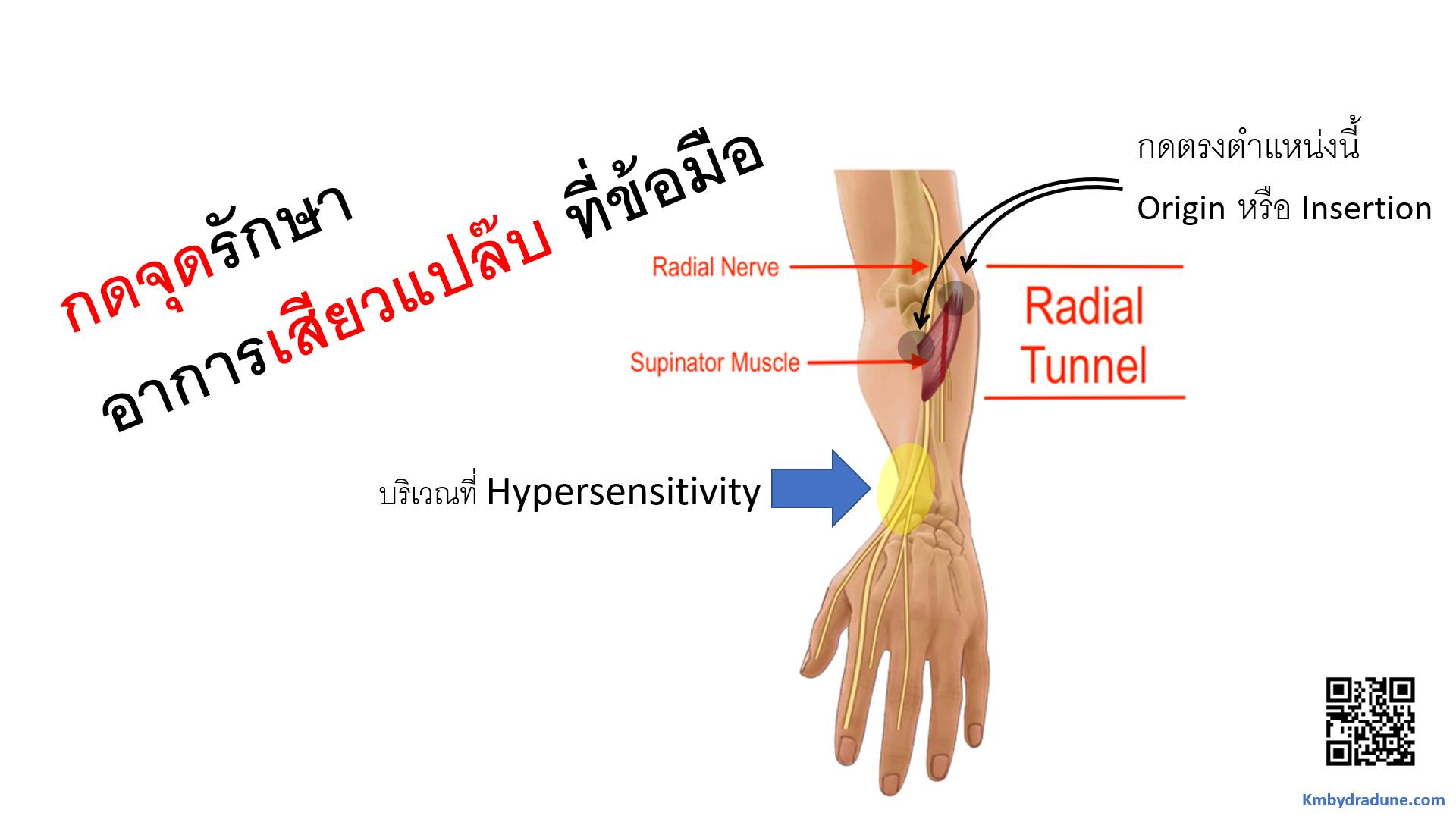 ใครมีอาการเสียวแปล๊บๆ ที่ข้อมือ หมอแนะวิธีกดจุดแก้ไขได้