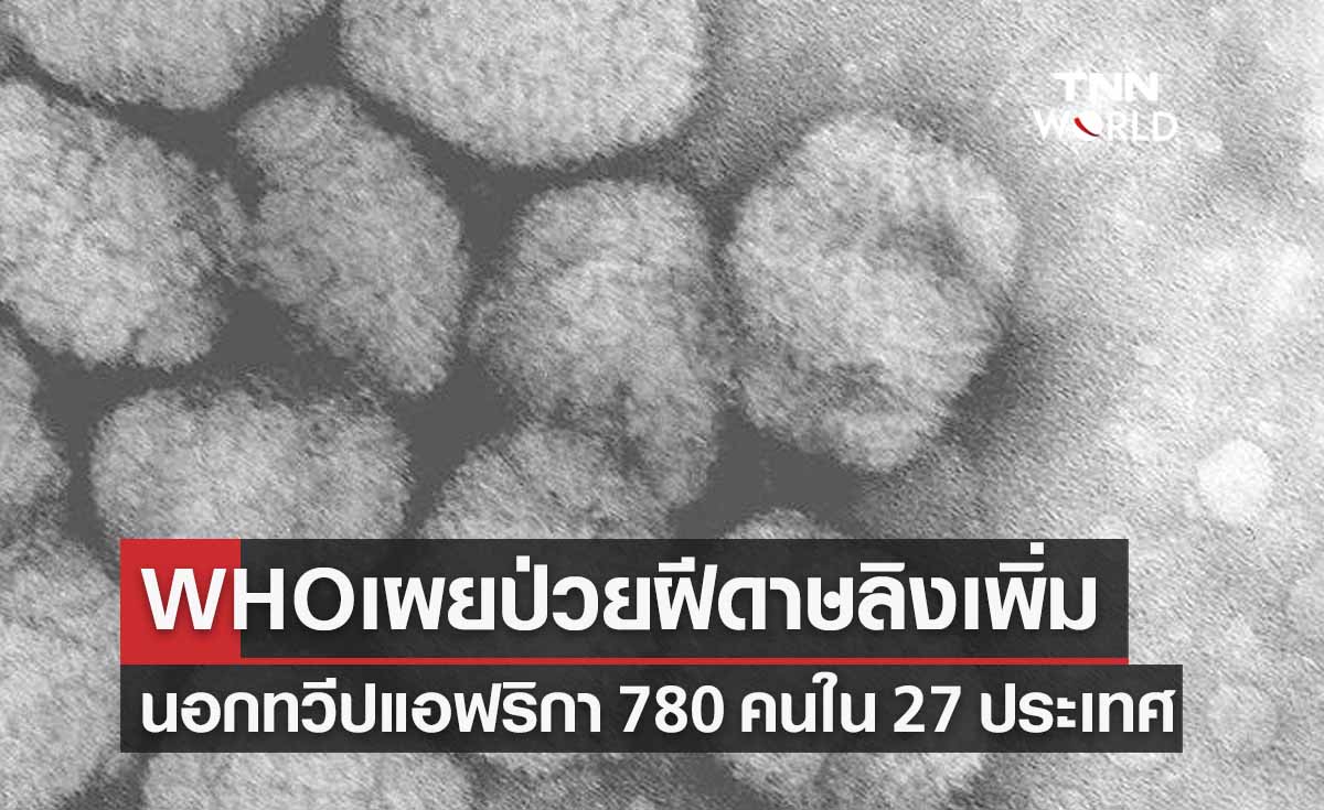 WHO เผยผู้ติดเชื้อฝีดาษลิงเพิ่มขึ้นเป็น 780 คนในรอบ 3 สัปดาห์ 