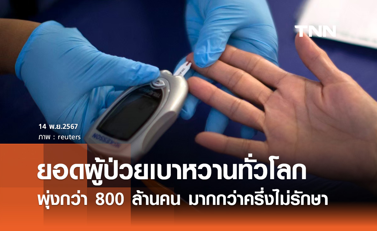 ป่วยเบาหวาน! เปิดข้อมูลล่าสุด พบทั่วโลกป่วยพุ่งกว่า 800 ล้านคน