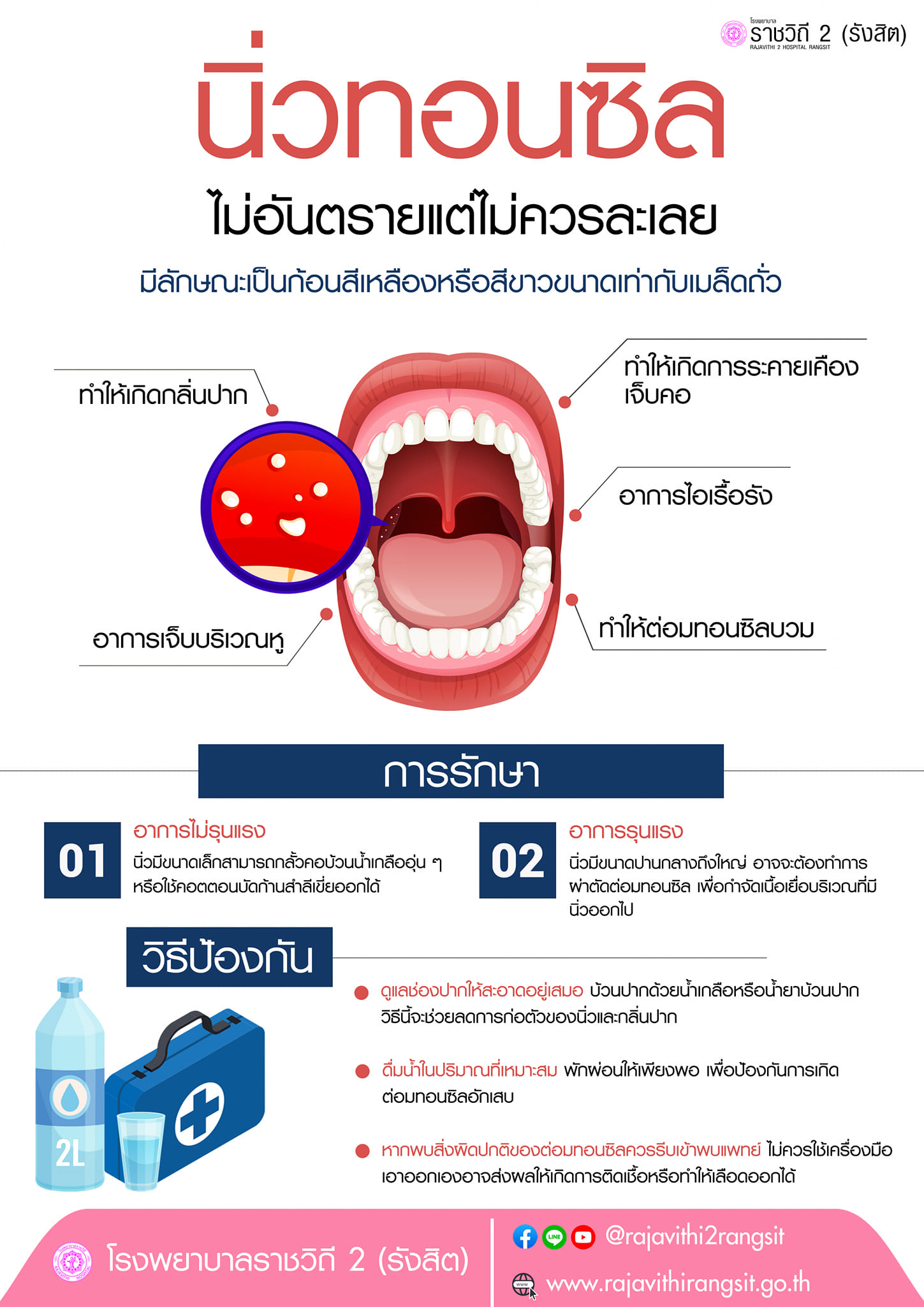 ก้อนเหลืองๆในคอ เกิดจากอะไร-หมอตอบชัดไม่อันตรายแต่อย่าละเลย