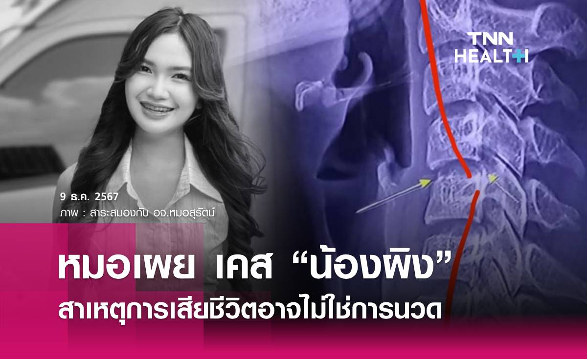 หมอประสาทเผย เคส “น้องผิง” สาเหตุการเสียชีวิตอาจไม่ใช่การนวด