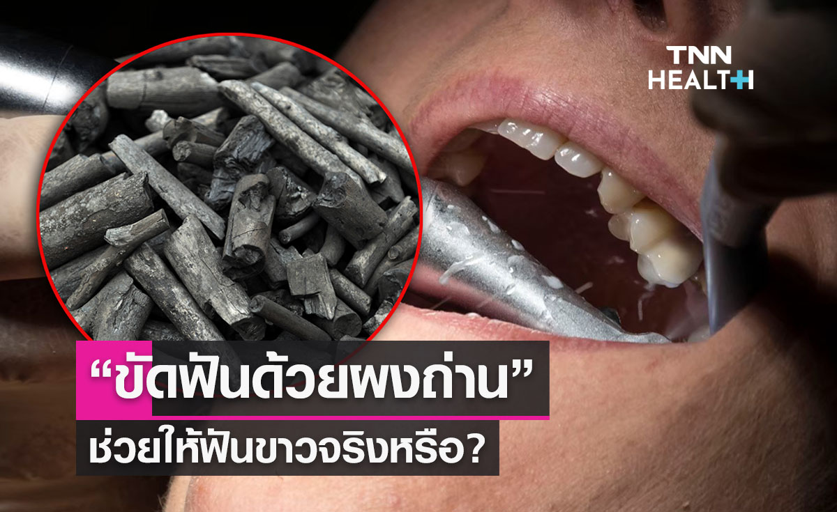 ไขความจริง “ขัดฟันด้วยผงถ่าน” ช่วยให้ฟันขาวจริงหรือ?