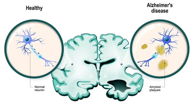 frontiers-sirtuins-as-potential-therapeutic-targets-for-mitigating