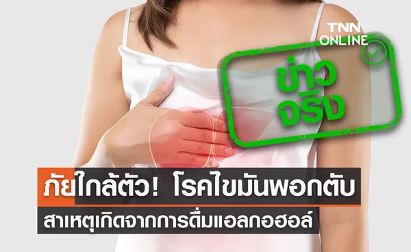 ภัยใกล้ตัว! โรคไขมันพอกตับ สาเหตุเกิดจากการดื่มแอลกอฮอล์-อาหารไขมันสูง