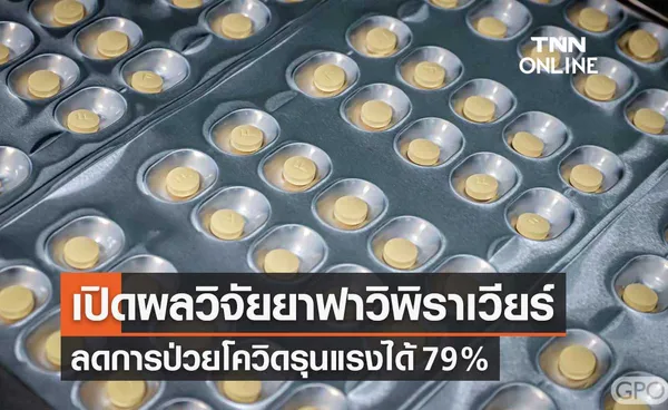 สธ.เปิดผลวิจัยประสิทธิภาพ ยาฟาวิพิราเวียร์ ลดอาการป่วยโควิดรุนแรง 79%