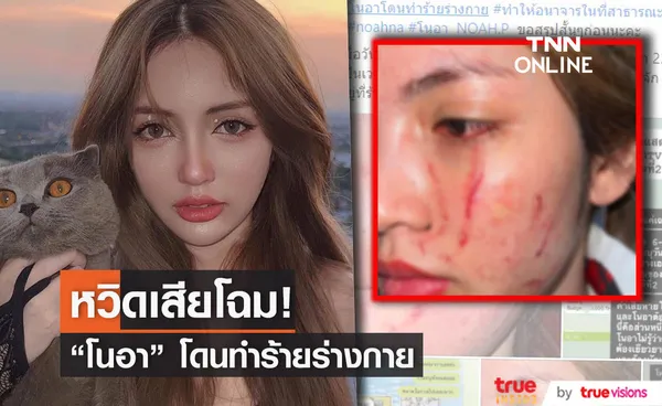 โนอา ภญมณ ว่าที่นางเอกถูกรุมทำร้ายร่างกาย