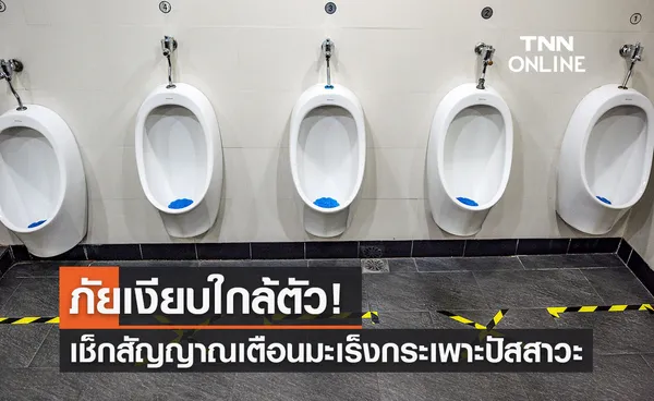 ภัยเงียบใกล้ตัว เช็กสัญญาณเตือน มะเร็งกระเพาะปัสสาวะ พบบ่อยในชายวัย 50 ปีขึ้นไป