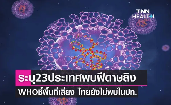 รวมจำนวนประเทศ ที่พบการระบาดของโรคฝีดาษลิง ล่าสุดวันนี้ (30 พ.ค.) พบใน 23 ประเทศ 