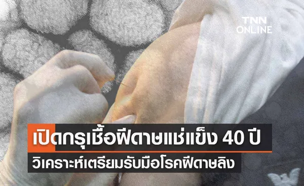 “อนุทิน”สั่งนำเชื้อฝีดาษแช่แข็ง 40 ปี ศึกษา เตรียมรับมือ “โรคฝีดาษลิง”