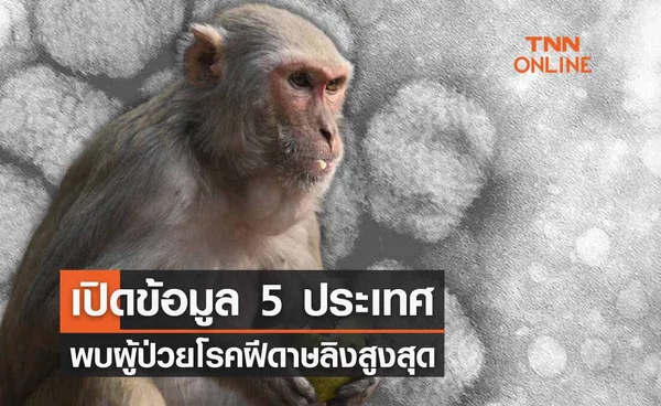 เปิดข้อมูล 5 ประเทศป่วย “โรคฝีดาษลิง” สูงสุด 