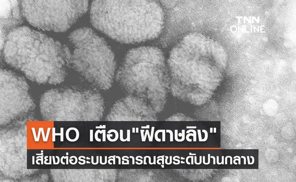 WHO เตือน ฝีดาษลิงเสี่ยงต่อระบบสาธารณสุขทั่วโลกในระดับปานกลาง